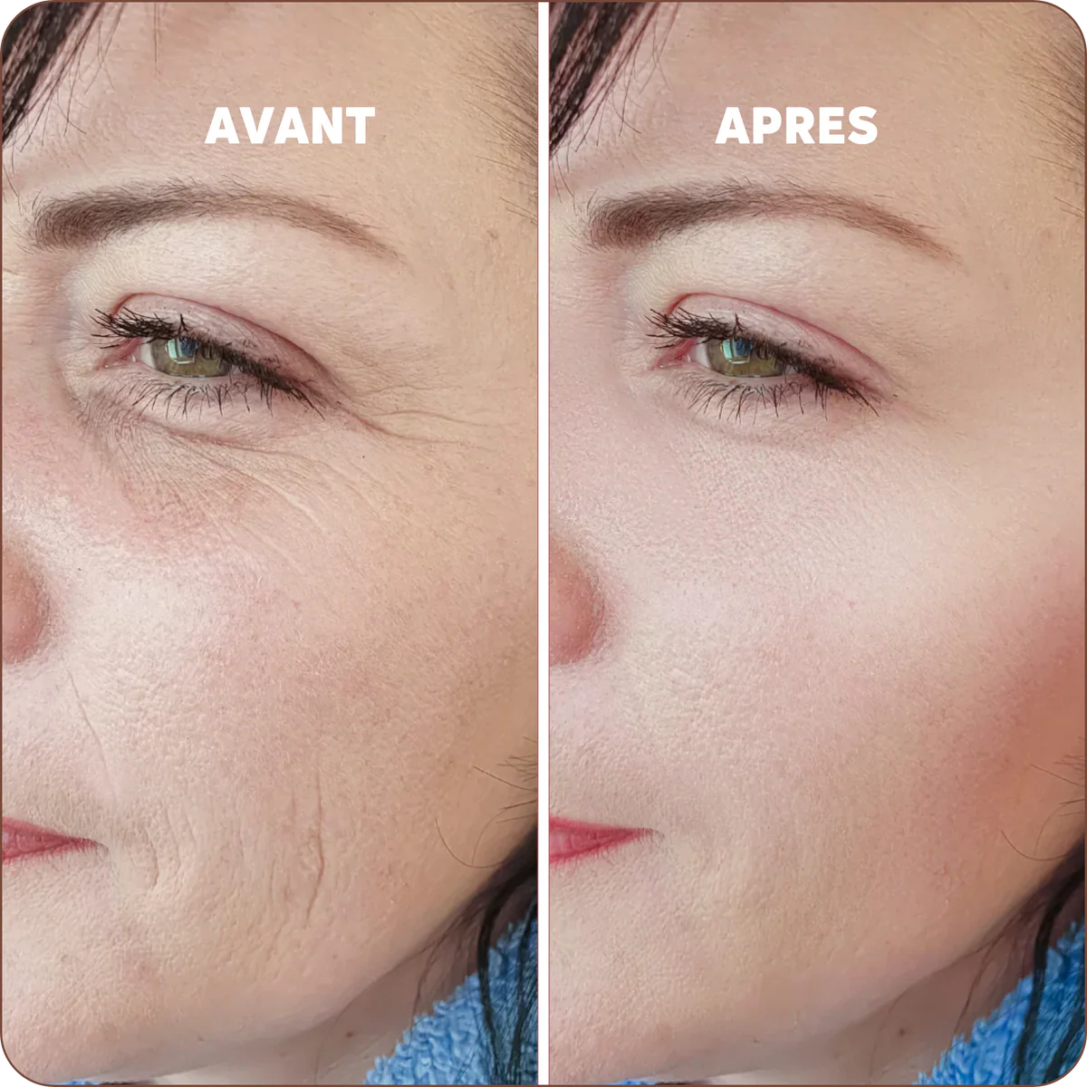 Baume Réparateur au Calcium | Peau reposée et rajeunie