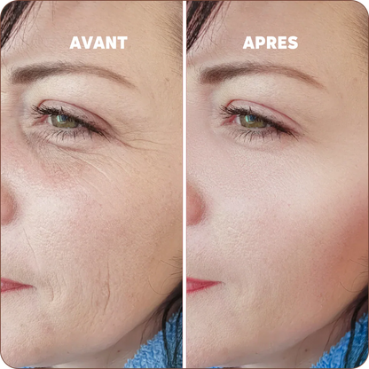 Baume Réparateur au Calcium | Peau reposée et rajeunie